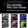 Clinical Dilemmas in Non-Alcoholic Fatty Liver Disease