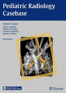 عکس Pediatric Radiology Casebase