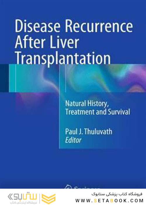 Disease Recurrence After Liver Transplantation : Natural History, Treatment and Survival