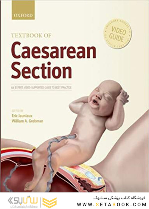 Textbook of Caesarean Section