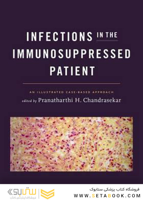 Infections in the Immunosuppressed Patient : An Illustrated Case-Based Approach