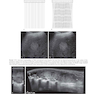 Ultrasound: The Requisites