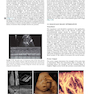 Ultrasound: The Requisites