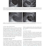 Ultrasound: The Requisites