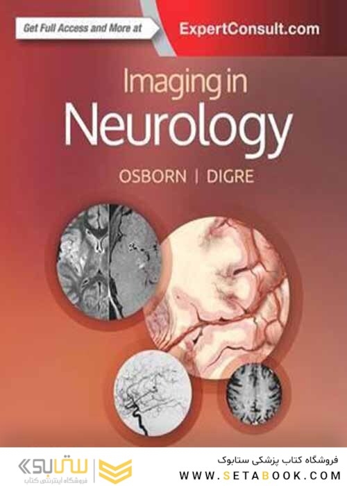 Imaging in Neurology