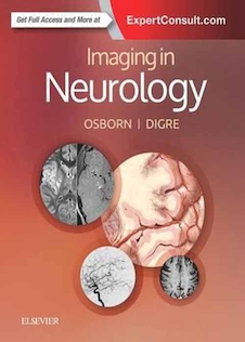 عکس Imaging in Neurology