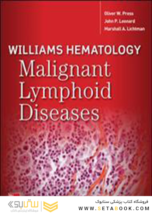 Williams Hematology Malignant Lymphoid Diseases
