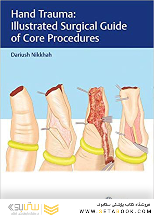 Hand Trauma: Illustrated Surgical Guide of Core Procedures