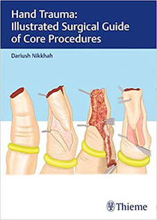 عکس Hand Trauma: Illustrated Surgical Guide of Core Procedures