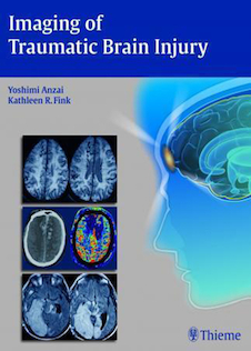 عکس Imaging of Traumatic Brain Injury
