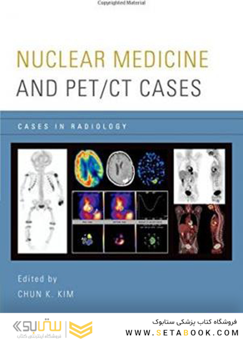 Nuclear Medicine and PET/CT Cases