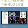 Nuclear Medicine and PET/CT Cases