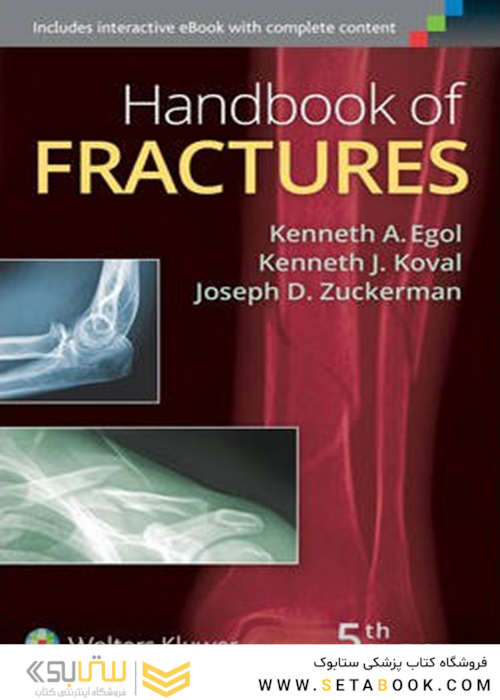 Handbook of Fractures