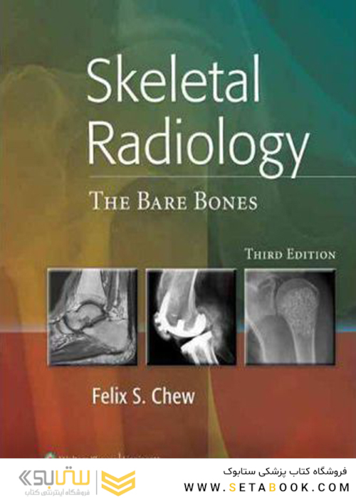 Skeletal Radiology : The Bare Bones