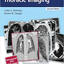 RadCases Plus Q-A Thoracic Imaging