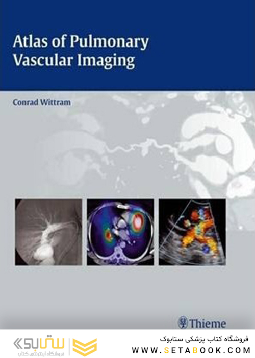 Atlas of Pulmonary Vascular Imaging