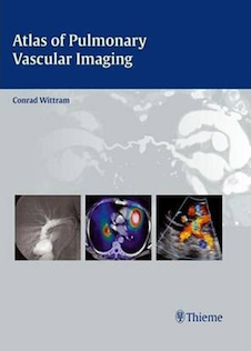 عکس Atlas of Pulmonary Vascular Imaging