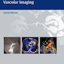 Atlas of Pulmonary Vascular Imaging