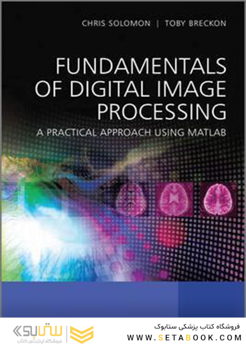 Fundamentals of Digital Image Processing : A Practical Approach with Examples in Matlab