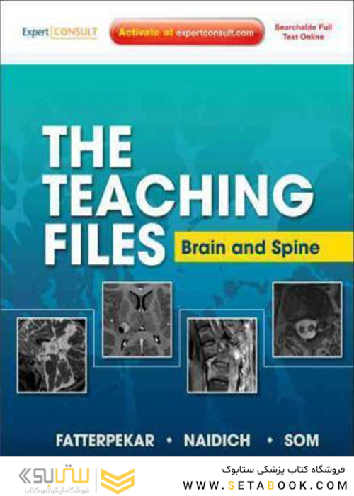 The Teaching Files: Brain and Spine : Expert Consult - Online and Print