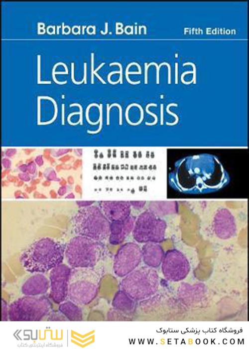 Leukaemia Diagnosis