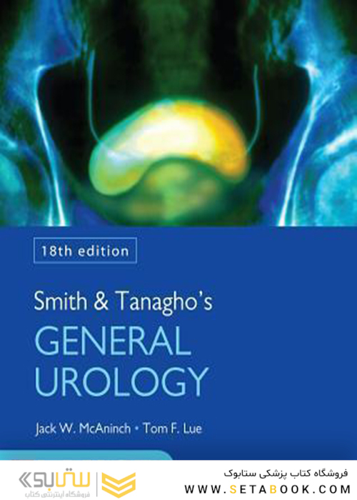 Smith and Tanagho