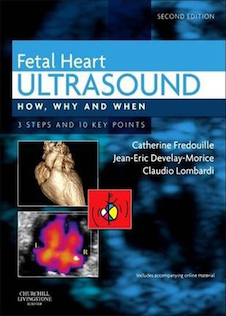عکس Fetal Heart Ultrasound : How, Why and When