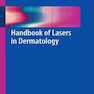 Handbook of Lasers in Dermatology