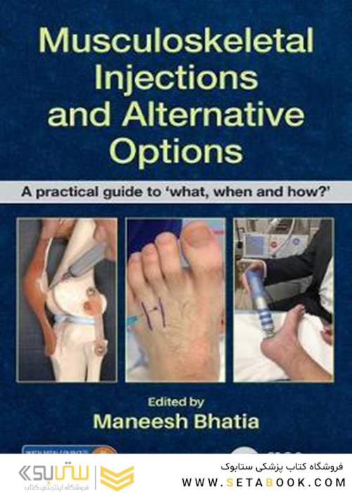 Musculoskeletal Injections and Alternative Options : A practical guide to 