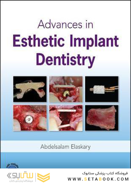 Advances in Esthetic Implant Dentistry2019