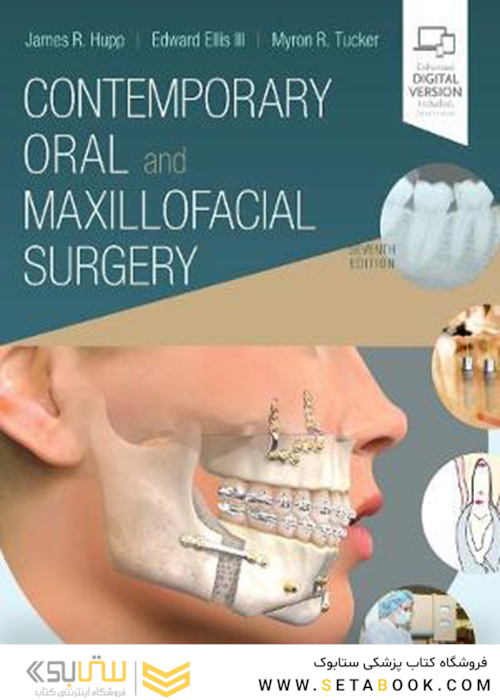 Contemporary Oral and Maxillofacial Surgery