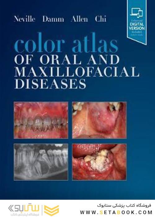 Color Atlas of Oral and Maxillofacial Diseases