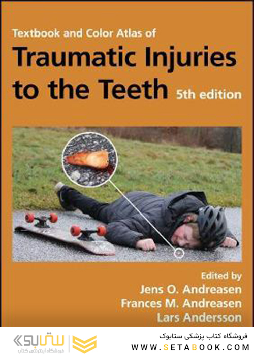 Textbook and Color Atlas of Traumatic Injuries to the Teeth