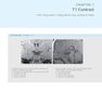 Duke Review of MRI Physics: Case Review Series
