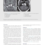 Duke Review of MRI Physics: Case Review Series