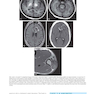 Duke Review of MRI Physics: Case Review Series