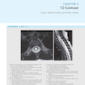 Duke Review of MRI Physics: Case Review Series