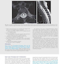 Duke Review of MRI Physics: Case Review Series