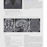 Duke Review of MRI Physics: Case Review Series