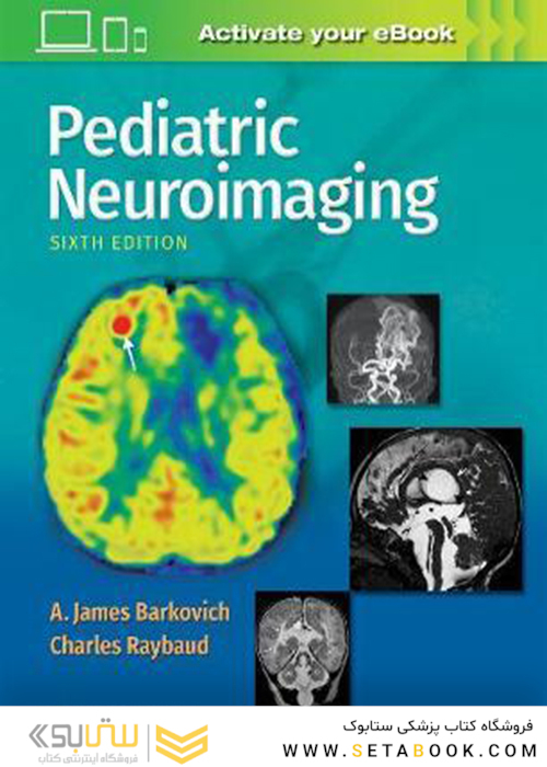 Pediatric Neuroimaging