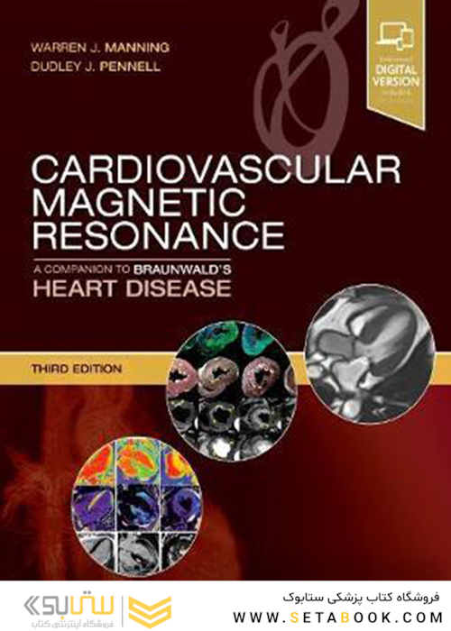 Cardiovascular Magnetic Resonance : A Companion to Braunwald