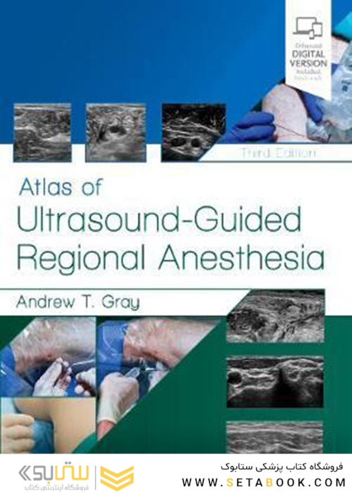 Atlas of Ultrasound-Guided Regional Anesthesia