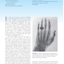 Radiobiology for the Radiologist