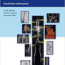  Arterial Variations in Humans