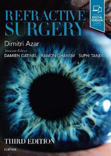 عکس Refractive Surgery