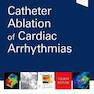 Catheter Ablation of Cardiac Arrhythmias
