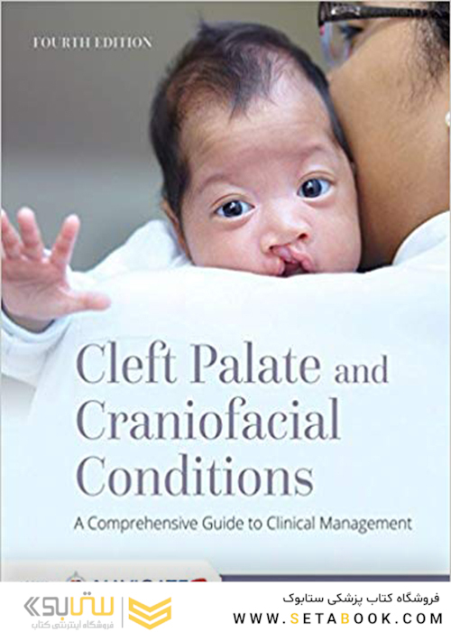 Cleft Palate And Craniofacial Conditions