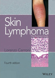 عکس Skin Lymphoma : The Illustrated Guide