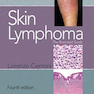 Skin Lymphoma : The Illustrated Guide