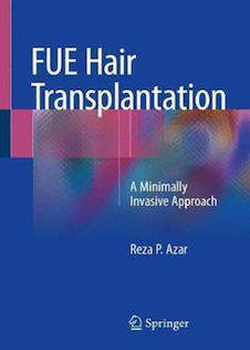 عکس Fue Hair Transplantation : A Minimally Invasive Approach